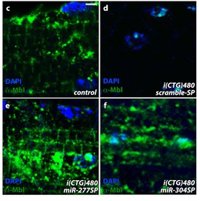 Investigadores españoles validan un método genético para tratar la distrofia miotónica de tipo 1