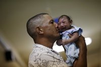 Honduras registra 16 nuevos casos de niños con microcefalia en las últimas tres semanas