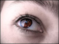 Retinopatía diabética: 10 preguntas y respuestas