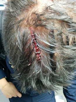 Tres policías fueron atendidos por brechas en la cabeza en el CIE de Murcia