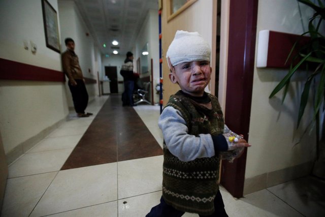 Un niño iraquí es tratado en un hospital en Erbil, cerca de Mosul