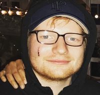 La princesa Beatriz de York corta accidentalmente a Ed Sheeran en la cara con una espada