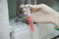 En 15 años en el 90% de los tumores se aplicará un tratamiento personalizado