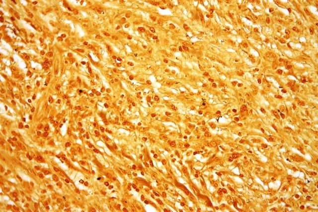 ‘Treponema Pallidum’, La Bacteria Causante De La Sífilis