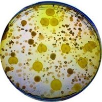 Los virus que sólo infectan a bacterias son propagadores de la resistencia a antibióticos