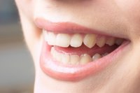 Consiguen remineralizar tejidos dentales con caries