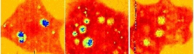 Resultado de la nueva técnica