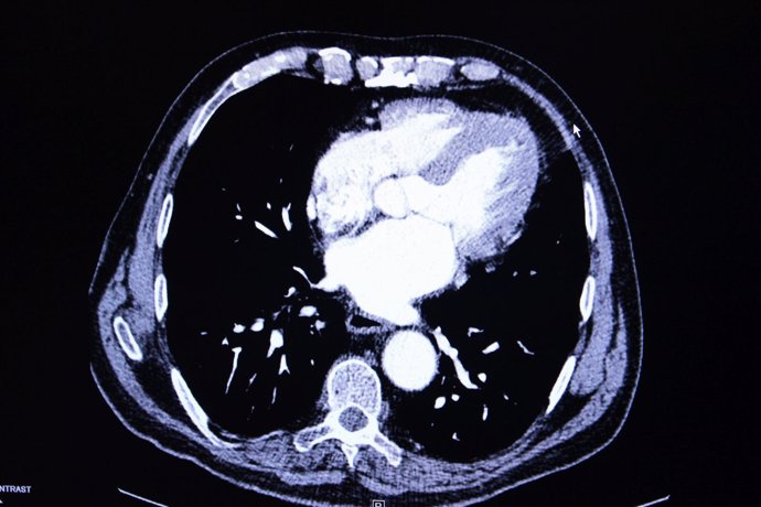 Radiografías, electroencefalogramas, actividad del cerebro, tumor