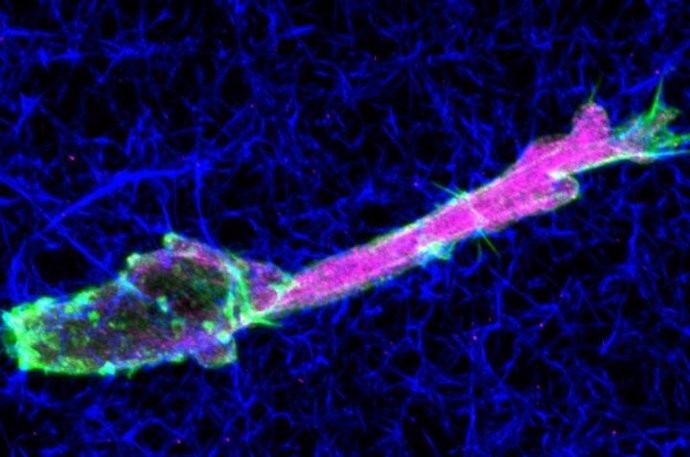 Célula tumoral migrando a través del colágeno