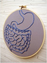 Cuando el cáncer colorrectal aparece pronto, puede ser hereditario