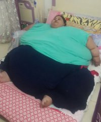 Hospital de India edifica instalación especial para operar a la mujer más obesa del mundo