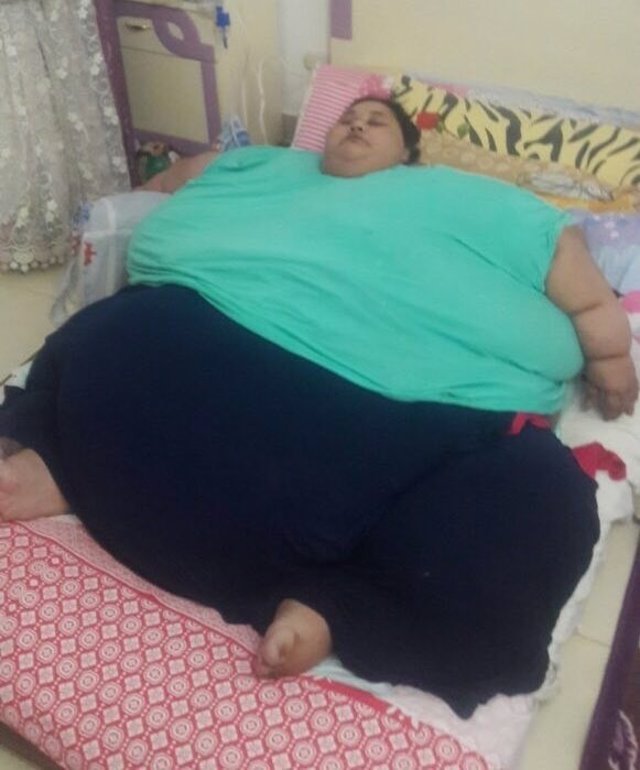 Eman Ahmed, la mujer más obesa del mundo