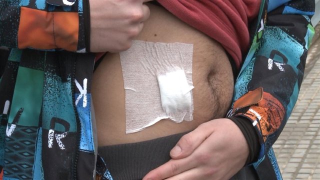 Herida sufrida por uno de los alumnos del instituto de Villena 