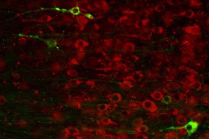 Una molécula paraliza el daño relacionado con el Alzheimer en ratones