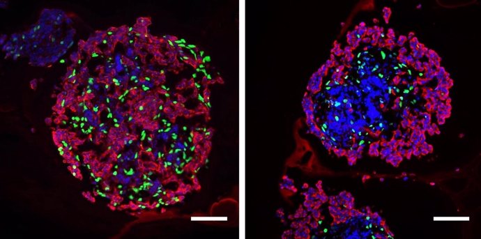 Islotes pancreáticos aislados tratados con hormona tiroidea T3