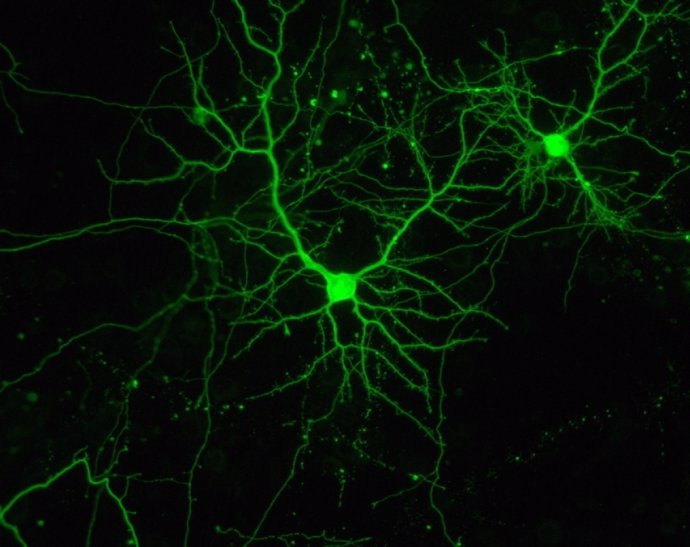 Dos neuronas, en cultivo