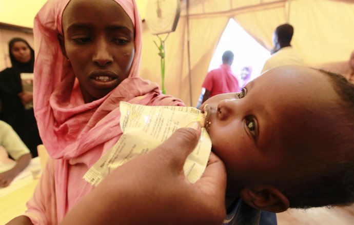 Niño malnutrido en Galkayo, Somalia
