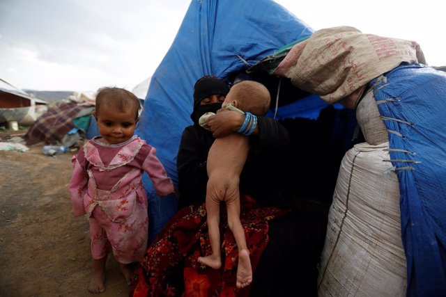 Una madre con su hijo desnutrido en Yemen