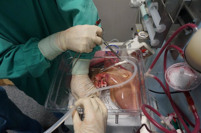 Cirujanos conectan un hígado al mecanismo de preservación                     