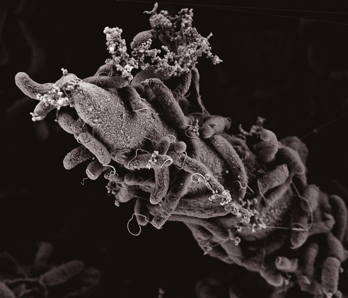 Bacteria del cólera vista microscópicamente.