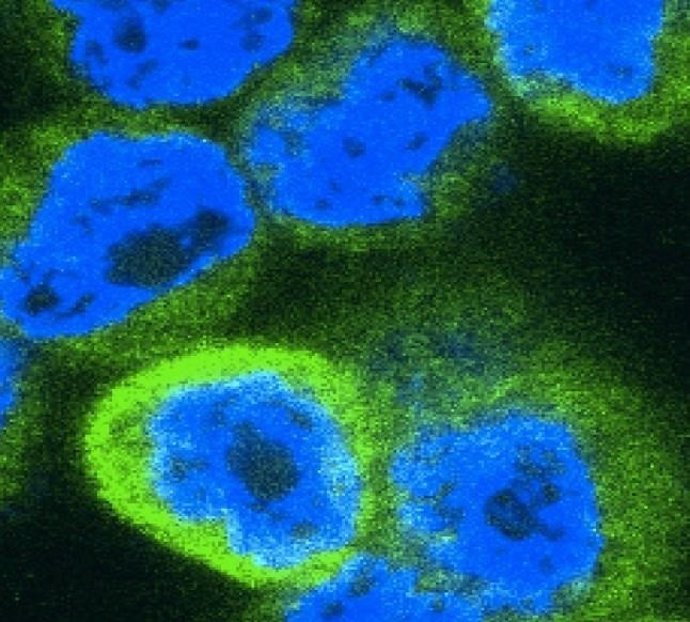 Identifican cómo los cánceres engañan al sistema inmunológico en su beneficio 
