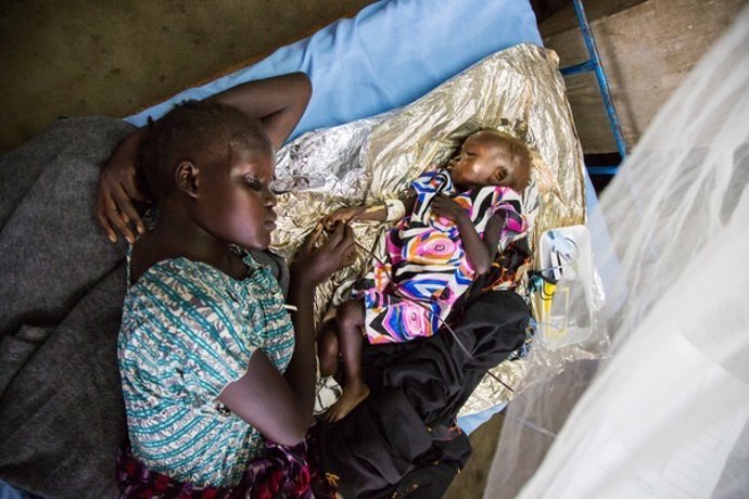 Una madre con su hijo desnutrido en un centro de tratamiento en Yuba