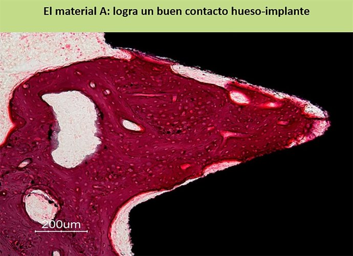 [Uji Premsa] L’Uji I La Upv/Ehu Aconsegueixen La Concessió D'una Patent Europea 
