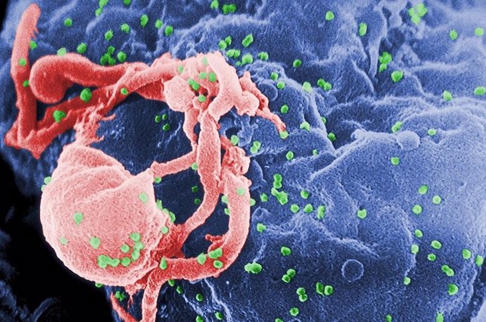 virus de la sida, VIH