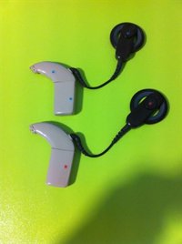 Día Mundial del Implante Coclear en Valladolid este sábado