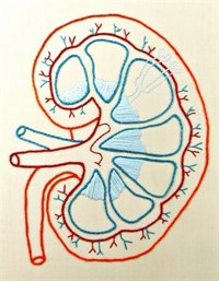 La prevalencia de la enfermedad renal crónica en España crece un 20% en la última década