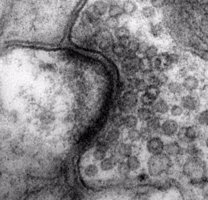 Transmisión de sinapsis asimétricas en dos áreas del cerebro