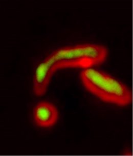 Mitocondrias con proteínas mal plegadas