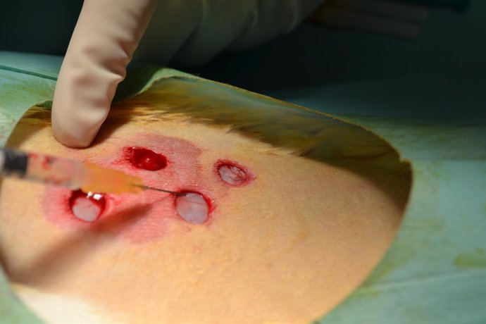 Nueva terapia para mejorar la cicatrización en heridas agudas