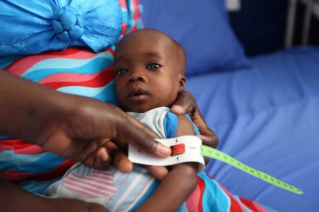 Un niño es atendido en el noreste de Nigeria por desnutrición 