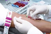 Un análisis de sangre podría ayudar a localizar precozmente el cáncer