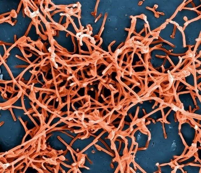 Partícules del virus de l'Ebola