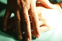 Nuevas técnicas "más rápidas" del diagnóstico de micosis y psoriasis en uñas