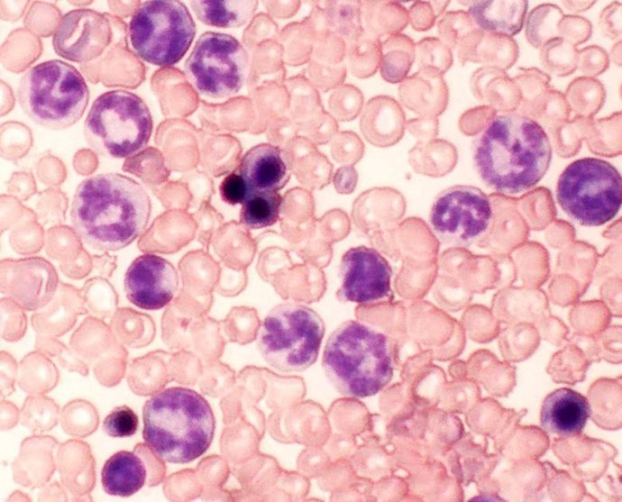 Células resistentes al tratamiento leucemia mieloide crónica (LMC) en ratón