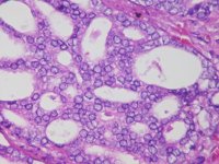 Investigadores descubren nuevos genes que cooperan para frenar el cáncer