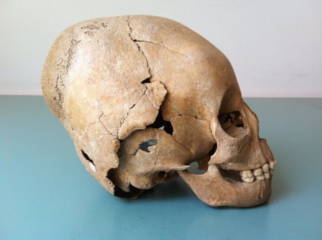 Cráneo modificado según las costumbres de los hunos