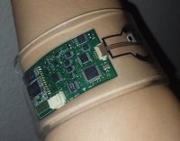 Esta pulsera puede diagnosticar la fibrosis quística