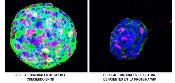 Identifican-una-proteina-clave-en-la-progresion-de-tumores-cerebrales_image_380