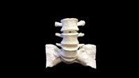 Asepeyo impulsa la impresión en 3D para su uso en traumatología en dos hospitales españoles