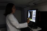 El tiempo que pasa entre el tumor y la metástasis marca la agresividad del cáncer de mama