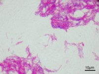 Descubren bacterias que activan células asesinas para eliminar el cáncer de vejiga