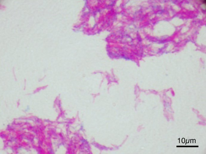 Bacilo de Calmette-Guérin al microscopio.