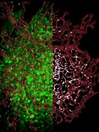 Las células tumorales comienzan el proceso de metástasis antes de lo que se pensaba
