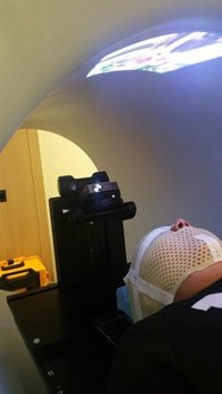 Películas en vez de anestesia general para las sesiones de radioterapia de niños con cáncer