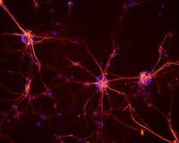 El VIH afecta la conectividad neuronal y al rendimiento cognitivo