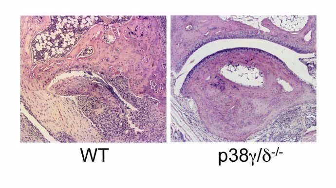 Ratones que carecen de p38γ/δ están protegidos frente al daño articular 